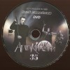   -   35 (17.11.2023 LIVE IN1930) (digipak) (2CD+DVD) - 